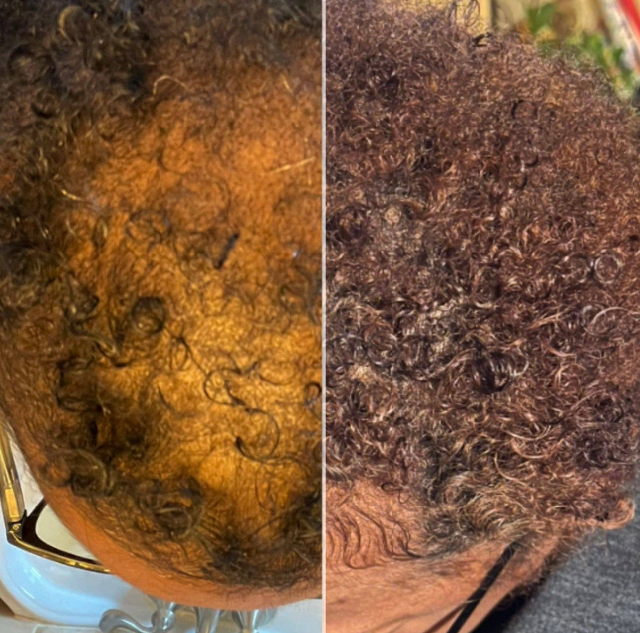HERSHE GROWTH OIL BEFORE AND AFTER 